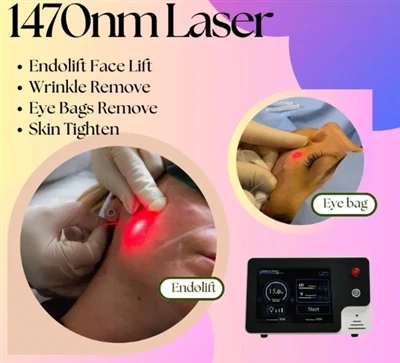Aplicações do diodo laser de fibra 1470nm 2,5W